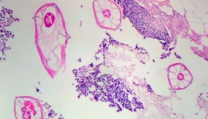 Beyond Simplex works