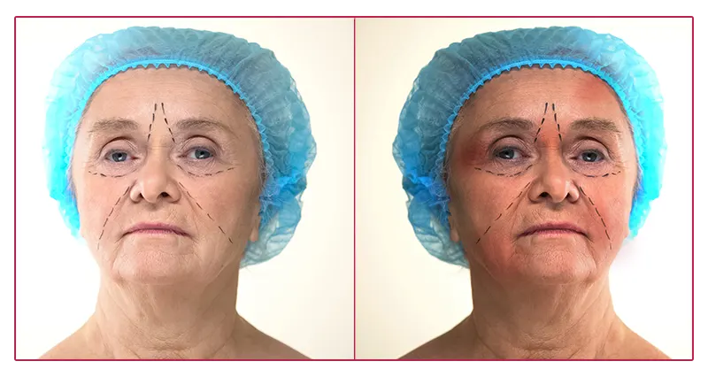 Glowic Customer Reviews